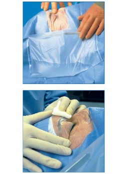 1061 Средняя офтальмологическая простыня  с разрезаемой пленкой ЗМ™ Steri-Drape™ и карманом