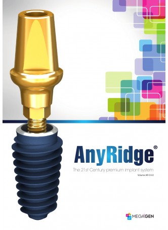 AnyRidge оптом