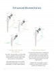 CORAIL® Hip System Design Rationale