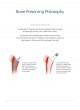 CORAIL® Hip System Design Rationale