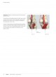 Expert Tibia Nail