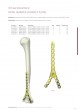 Trauma Plates&Screws Catalog оптом
