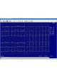 Скрининговый аудиометр PDD-702