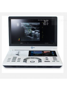 Переносной ультразвуковой сканер eZono®5000