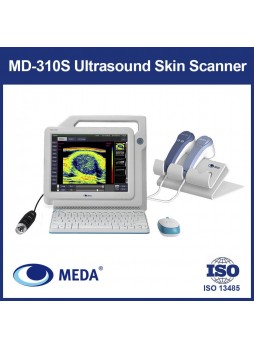 Переносной ультразвуковой сканер MD-310S