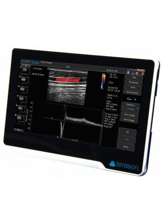 Переносной ультразвуковой сканер uSmart 3200T™ NEXGEN