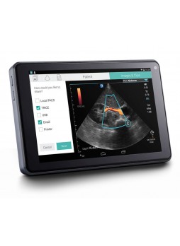 Портативный ультразвуковой сканер SonoSite iVIZ