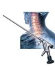 Спиналоскоп VERTEBRIS cervical оптом