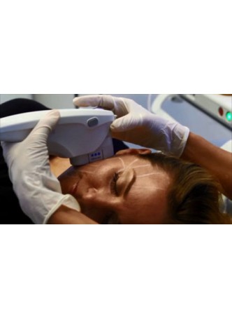 Аппарат HIFU для контурной пластики тела Ultherapy® оптом