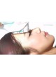 Аппарат HIFU для контурной пластики тела Ultherapy® оптом