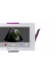 Переносной ультразвуковой сканер SensUS Touch оптом