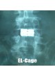 Интеркорпоральный кейдж для поясничной зоны EL-Cage