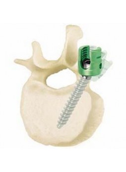 Транспедикулярный винт грудо-поясничный позвонок WSI MX/PX-Titan®