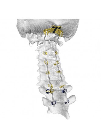 Затылочно-шейно-грудная система остеосинтеза TIGER® оптом