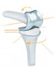 Имплантат межфалангового сустава кисти руки PIPR™ оптом