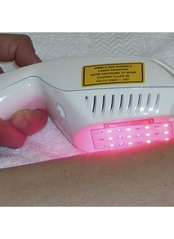 Лазер для дерматологии POLYLASER EXPERT
