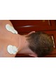 Подушечка для электростимуляции Painmaster MCT patch