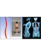 Система оценки осанки 3D B.A.K. Body Analysis Kapture оптом