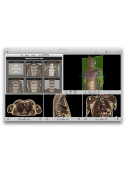 Анатомическое программное обеспечение VH Dissector for Medical Education