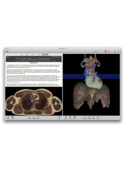 Анатомическое программное обеспечение VH Dissector for Medical Education