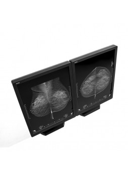 Маммографический монитор MX50N