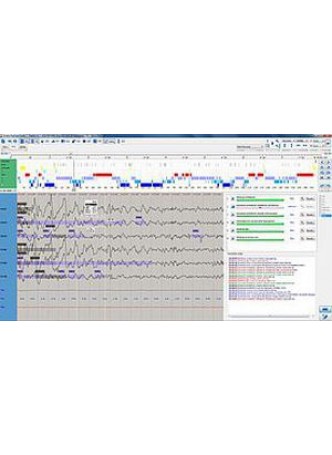 Модуль программного обеспечения для EMG EEGDigiTrack™ PSG оптом