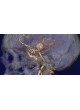 Медицинский модуль программного обеспечения Aquarius iNtuition