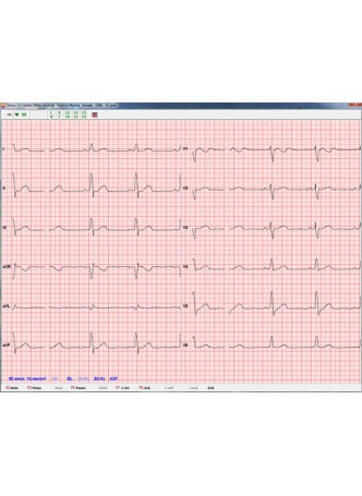 Модуль программного обеспечения для электрокардиографии ArMaSoft-12-Cardio оптом