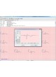 Модуль программного обеспечения для электрокардиографии ArMaSoft-12-Cardio оптом