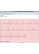 Модуль программного обеспечения для электрокардиографии ArMaSoft-12-Cardio оптом