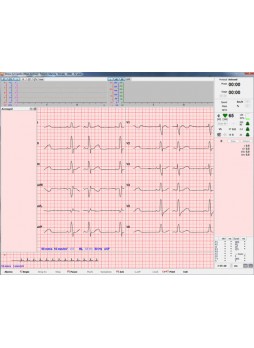 Модуль программного обеспечения для электрокардиографии Stress-12-Cardio
