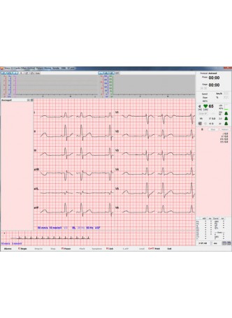 Модуль программного обеспечения для электрокардиографии Stress-12-Cardio оптом