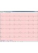 Модуль программного обеспечения для электрокардиографии Stress-12-Cardio оптом