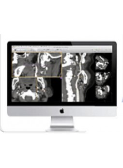 Модуль программного обеспечения для медицинских снимков ayVessel