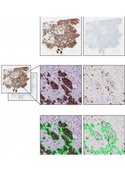 Модуль программного обеспечения для лаборатории гистопатологии VirtualDoubleStaining™ (VDS)