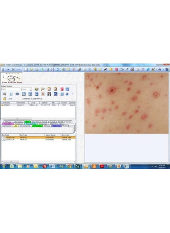 Модуль программного обеспечения для личных дел пациентов Dermatology