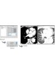 Модуль программного обеспечения для маммографии OsiriX PRO