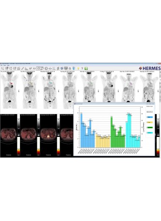 Модуль программного обеспечения для медицинских снимков Hybrid Viewer™ оптом