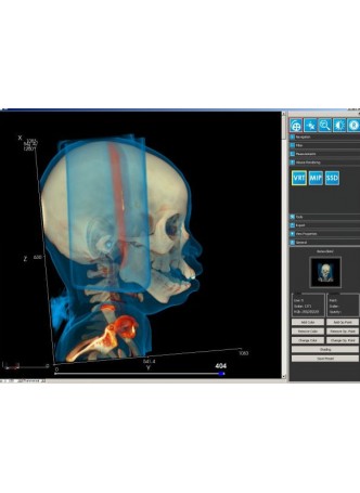 Модуль программного обеспечения для медицинских снимков iQ-3D оптом