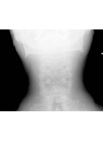 Модуль программного обеспечения для рентгенологии DexView DR оптом