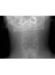Модуль программного обеспечения для рентгенологии DexView DR оптом