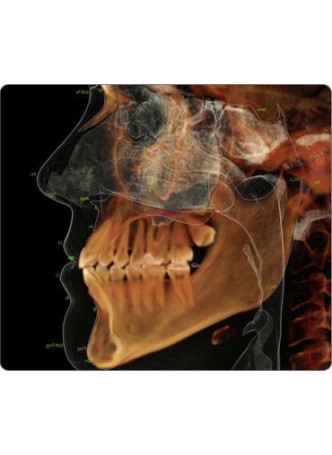 Модуль программного обеспечения для обработки снимков зубов оптом