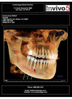 Модуль программного обеспечения для обработки снимков зубов Report