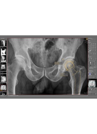 Модуль программного обеспечения для медицинских снимков dicomPACS® Prosthesis оптом