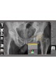 Модуль программного обеспечения для медицинских снимков dicomPACS® Prosthesis оптом