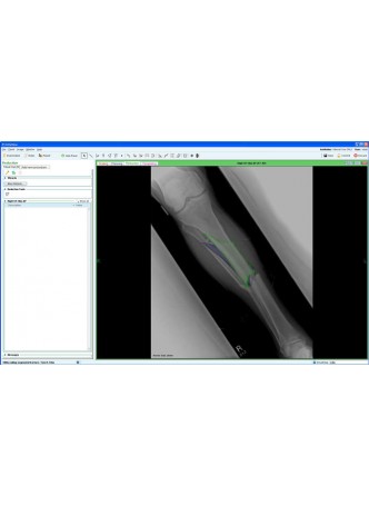 Модуль программного обеспечения для управления Fracture Management оптом