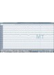 Модуль программного обеспечения для полисомнографии SLEEP module оптом