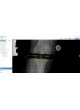 Модуль программного обеспечения для предоперационного планирования mediCAD Web оптом