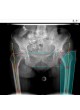 Модуль программного обеспечения для предоперационного планирования mediCAD Web оптом