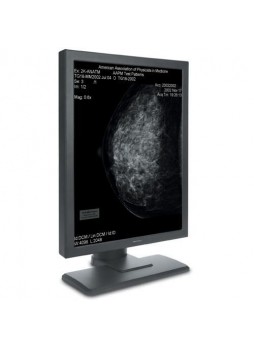 Маммографический монитор JUSHA-M53